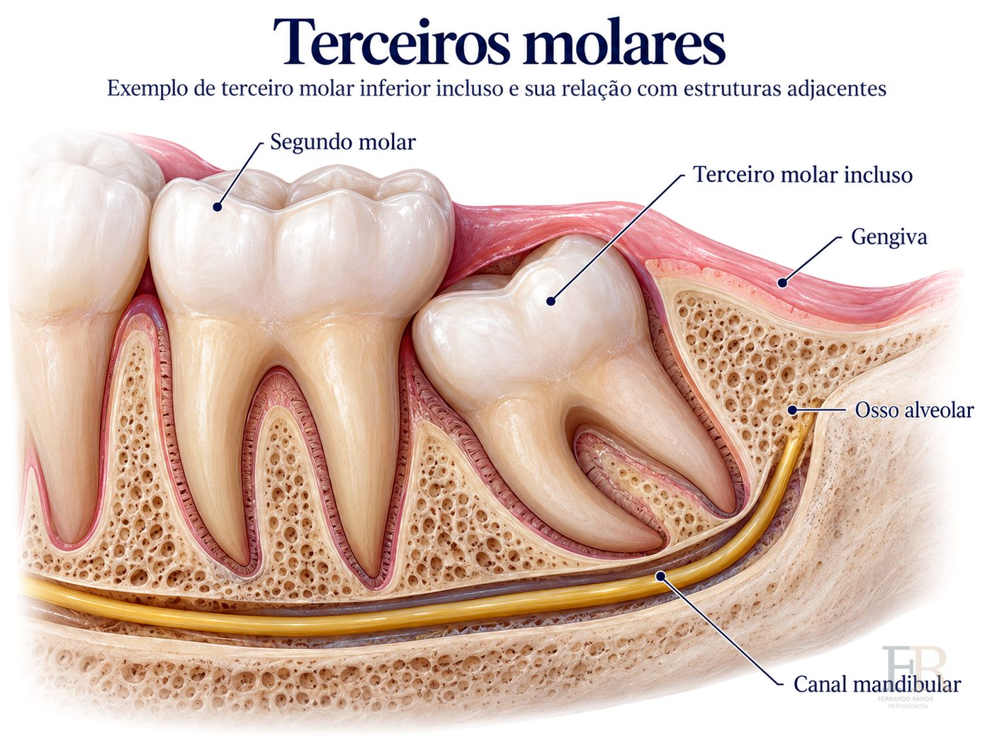 Cirurgia oral menor